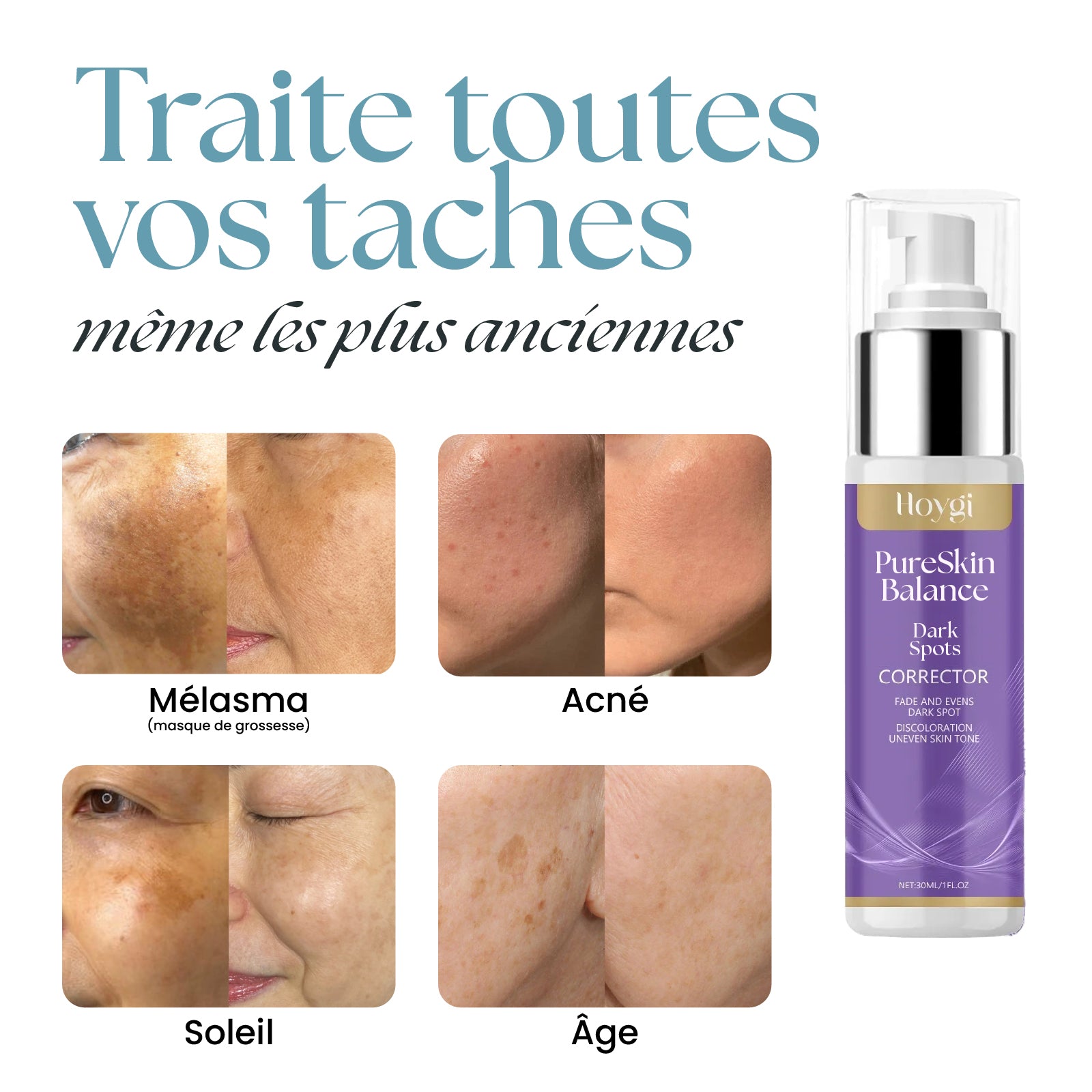 PureSkin Balance - Crème anti-taches