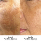 PureSkin Balance - Crème anti-taches