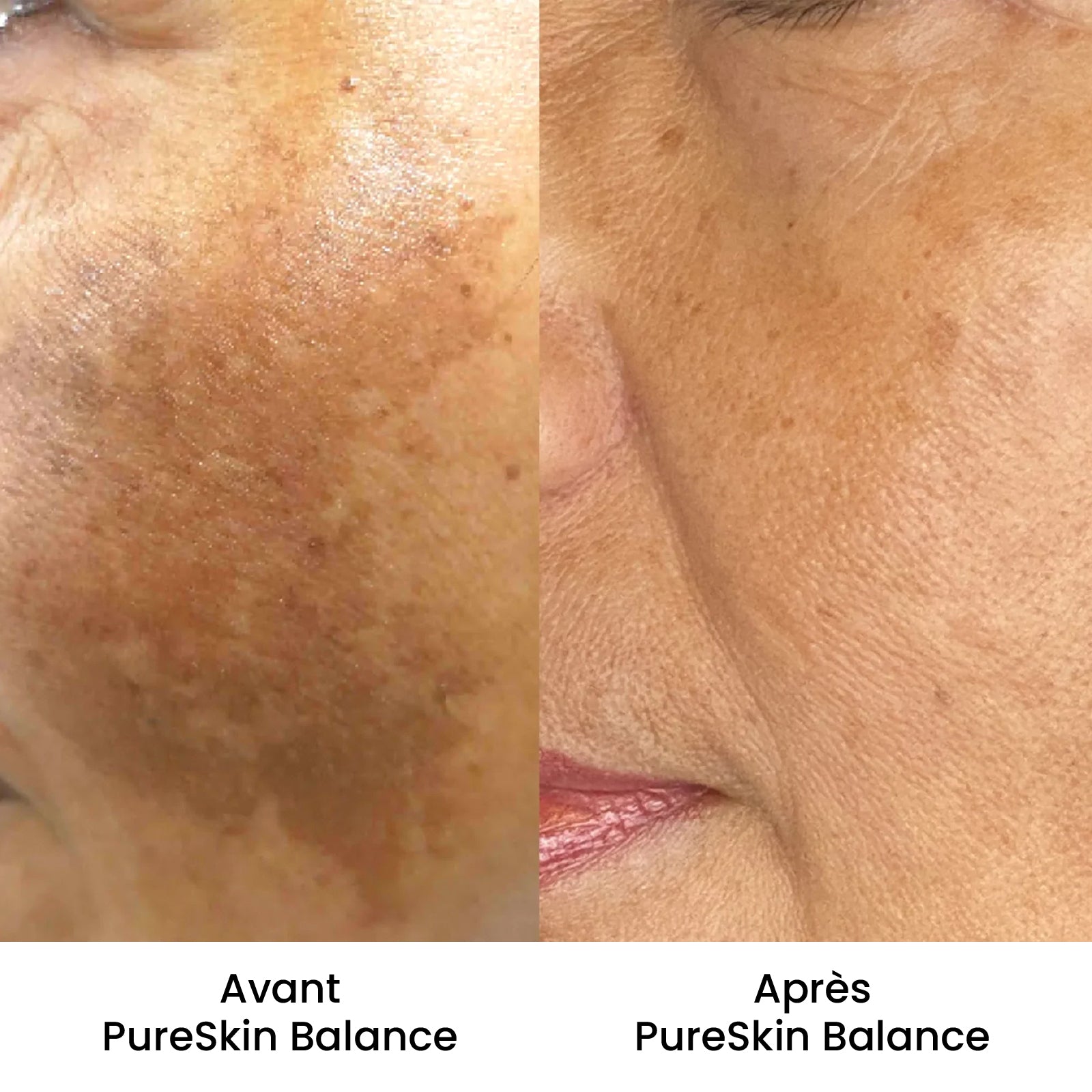 PureSkin Balance - Crème anti-taches