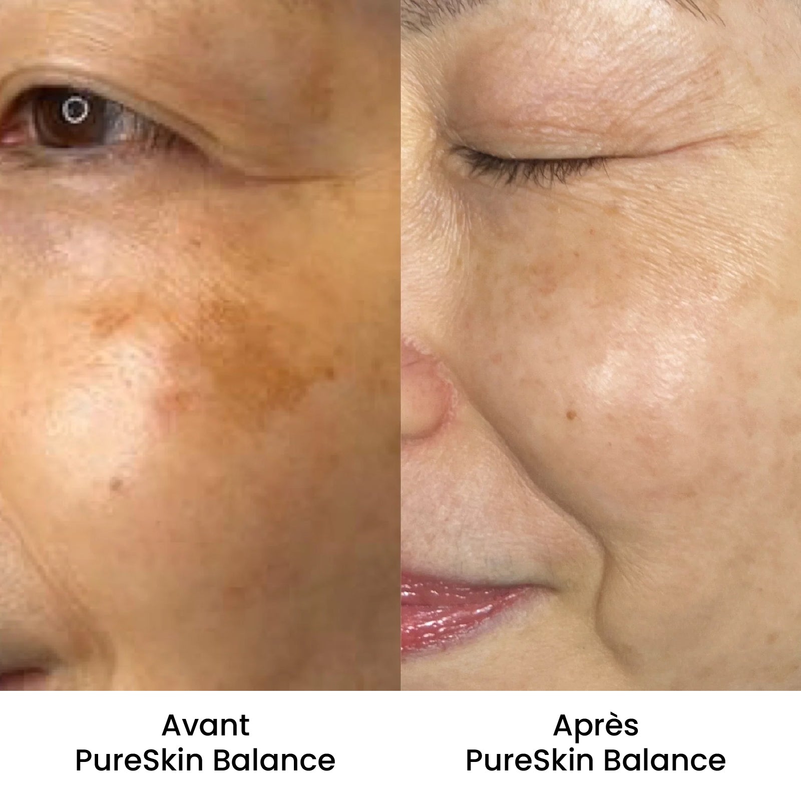 PureSkin Balance - Crème anti-taches